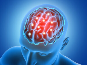 Neurodegenerative Specialist